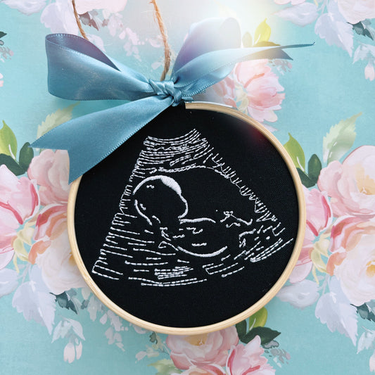 Ultrasound Embroidery Frame